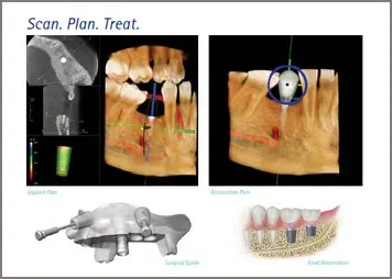 Scan. Plan. Treat. with example of 3d imaging